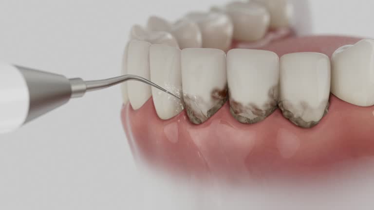 Trusted Teeth Whitening service in North Vacherie, LA - Dentist Open Now